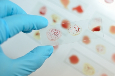 Le vitaliseur de Marion pour une cuisson optimum